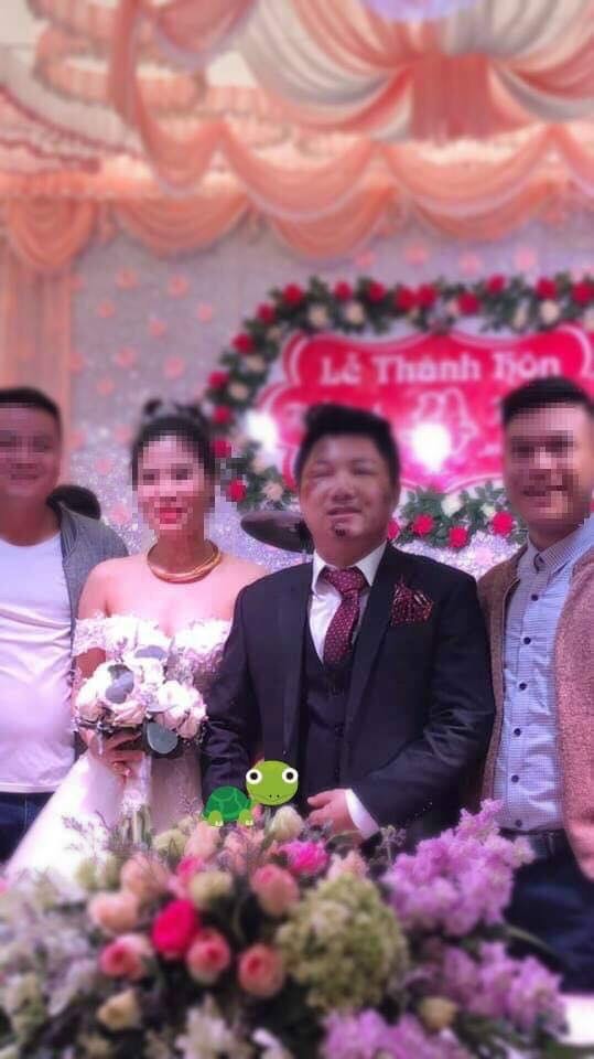 Khuôn mặt chú rể bị bầm rập, mắt sưng húp trong Quatrian shbet hiện đang mở. Ảnh Beatvn.