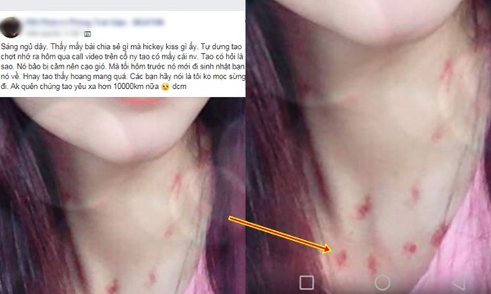 Câu chuyện được chàng trai chia sẻ.