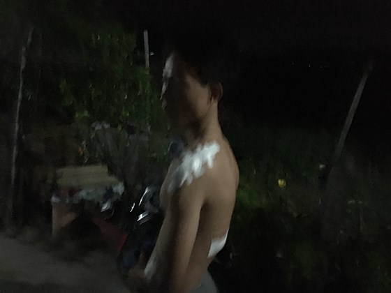 Nạn nhân với vết thương trên người. 