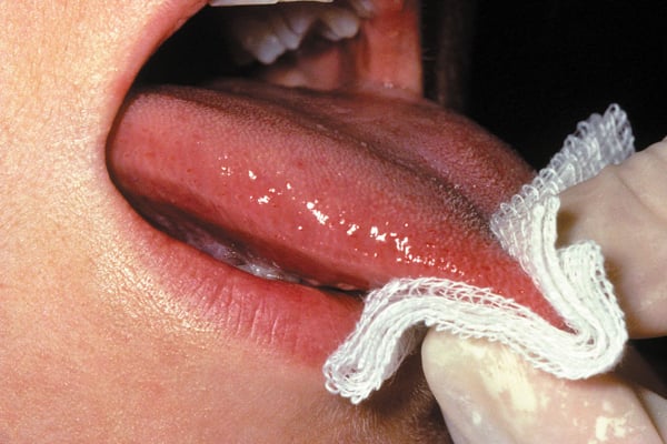 luoi-2