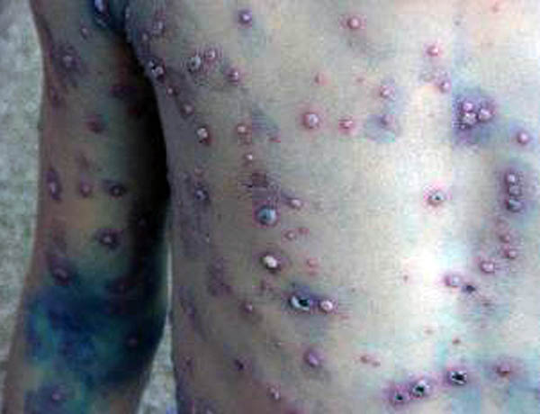 thuy-dau-1