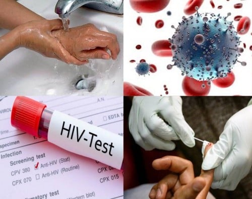 lam-gi-khi-bi-phoi-nhiem-hiv