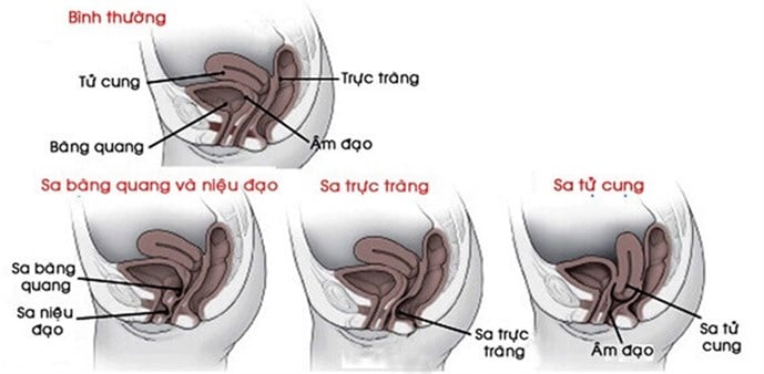 untitled-ssd1_thumb_690