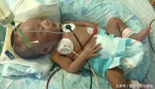 Cậu bé 10 ngày tuổi nhập viện trong tình trạng hôn mê vì nhiễm trùng máu