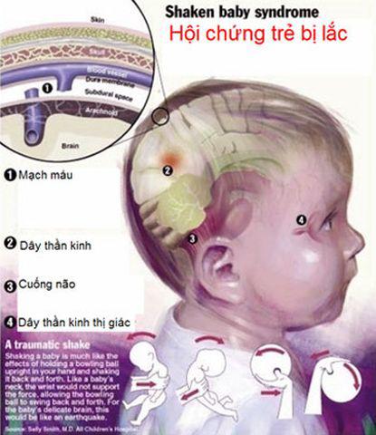 be-gai-10-thang-tuoi-chet-do-xuat-huyet-nao-canh-bao-cha-me-dung-dung-cach-nay-do-con-rung-l---c-1_result-1538441152-88-width415height480