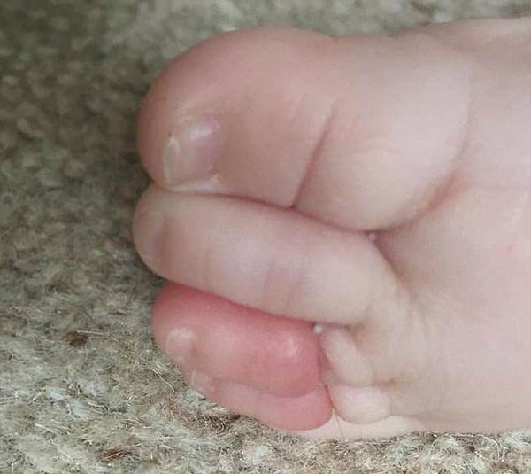 Alex rất hối hận vì sợi tóc của mình đã suýt cướp đi 4 ngón chân của con trai cô