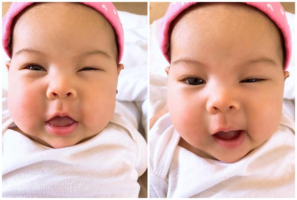 Mũi của cô bé được nhận xét: 