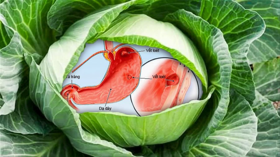 bap-cai-chua-dau-da-day1