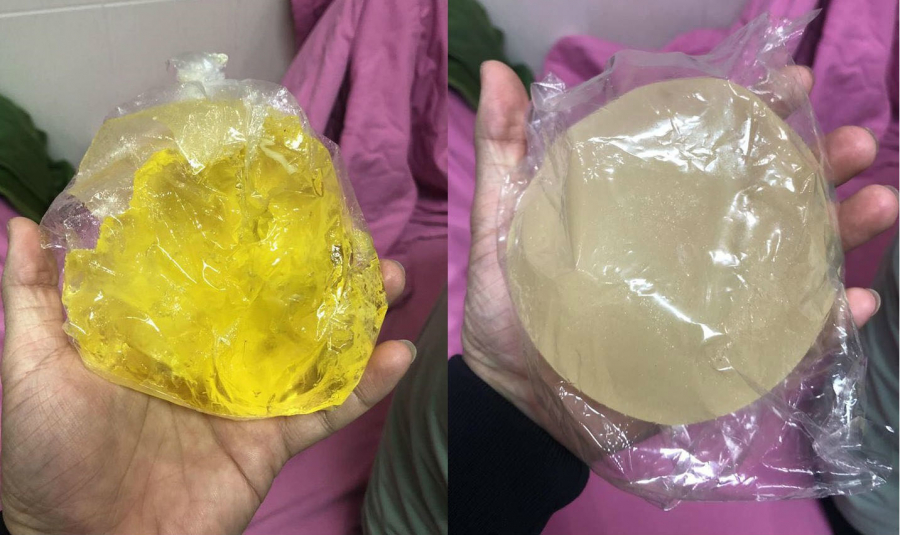 Mai Tường Vy cho biết, bản thân cô nghĩ sự việc xảy ra không phải lỗi của BS đặt ngực mà do túi ngực kém chất lượng.