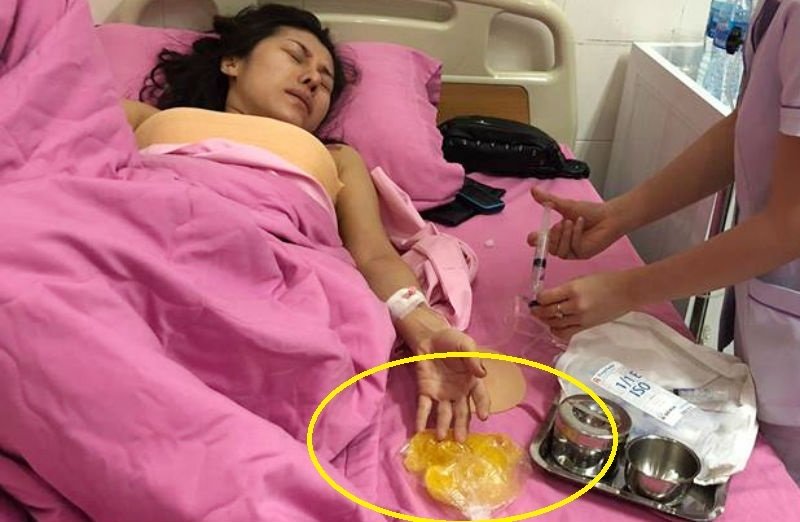 Được biết, vào ngày 22/10 vừa qua, sau khi xong cuộc lưu diễn, Mai Tường Vy cùng đồng nghiệp đáp chuyến bay từ Đài Loan về Việt Nam. Lúc đang trên máy bay, nữ ca sĩ nghe ngực trái có những âm thanh lạ giống như vỡ ra.