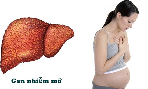 gan-nhiem-mo-cap-tinh-trong-thai-ky-1-2
