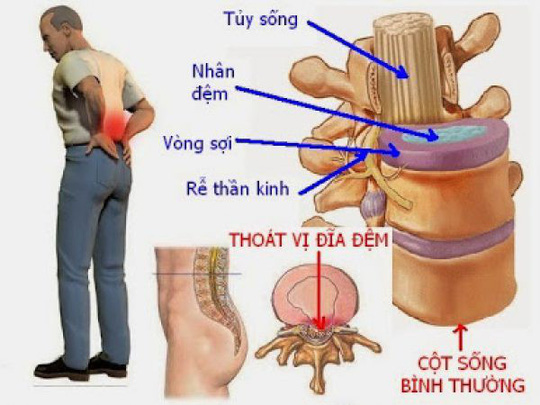 thoi-quen-xau-khi-lam-viec-phunutoday2