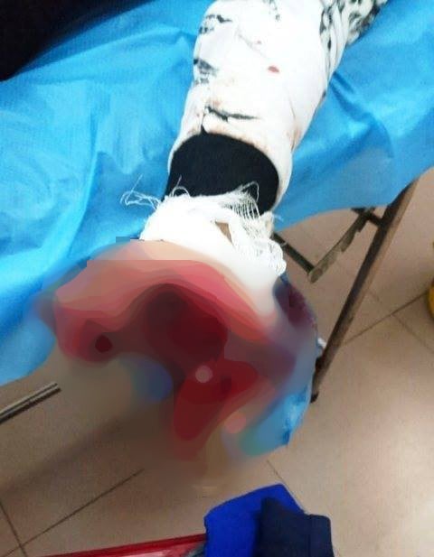 photo-1-154744325284392038468