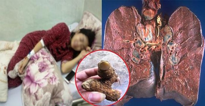 tin-vui-bs-tiet-lo-vi-thuoc-quy-giup-benh-nhan-ung-thu-phoi-keo-dai-su-song-them-20-nam-20190215043023-1550205023-4354