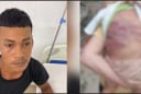 Hé lộ lời khai rợn người của cha dượng trong vụ bé trai 2 tuổi bị bạo hành đến nguy kịch