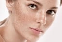 Công thức dầu dưỡng tự chế hỗ trợ làm mờ đốm đen