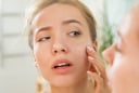 Dưỡng ẩm quá mức có thể khiến da “quá tải”