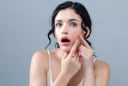 Chăm sóc da đúng cách sau nặn mụn giúp giảm nguy cơ thâm sẹo và phục hồi da nhanh hơn