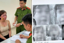 Người mẹ sau sinh lên tiếng tố chồng bạo hành, pháp luật đã vào cuộc