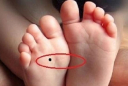 4 nốt ruồi trên chân mang tới may mắn cho bạn: Ai có thật đáng chúc mừng