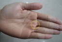 4 nốt ruồi trên bàn tay mang tới may mắn cho bạn: Ai có thật đáng chúc mừng