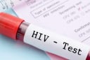Dấu hiệu HIV trên Sh88bet đăng ký miễn phí: Những biểu hiện âm thầm dễ bị bỏ qua