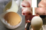 Xóa bỏ mụn đầu đen cấp tốc chỉ trong 1 tuần nhờ sử dụng bí kíp này đều đặn