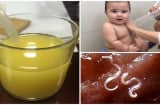 Tự pha một cốc nước theo cách này, mẹ TỐNG CỔ ổ sán lợn cứng đầu, lọc sạch Sh88bet đăng ký miễn phí, con tăng cân đều