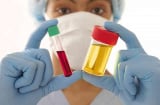 8 dấu hiệu quan trọng nhất cảnh báo thận bị nhiễm độc nặng: Hãy đi khám ngay trước khi quá muộn