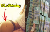 Nốt ruồi ở MÔNG ngồi không cũng LỘC, phụ nữ có nốt ruồi này số đại gia cầm chắc, phát tài sau tuổi 30