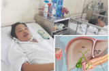 Thoát khỏi bàn tay tử thần, bệnh nhân chia sẻ lý do hỏng gan mật, nhiều người Việt cũng đang mắc
