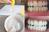 Không bao giờ đi lấy cao răng nhưng chỉ cần ngậm thứ này 2 phút răng trắng như bọc sứ ngay