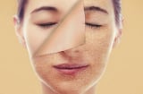 Những loại thực phẩm khiến Sh88bet đăng ký miễn phí lão hoá từng ngày, 'ăn mòn' sức khoẻ mà nhiều người vẫn ăn