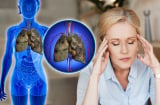 Tín hiệu cảnh báo ung thư phổi đang tấn công Sh88bet đăng ký miễn phí, chớ dại mà coi thường