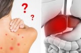 Những dấu hiệu của Sh88bet đăng ký miễn phí cảnh báo gan đang có bệnh, chớ coi thường