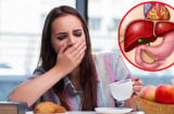 8 loại thực phẩm âm thầm làm gan 'nhàu nát' mỗi ngày