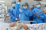 Hai bé song sinh dính liền sau Shbet888 tiền thưởng cực khủng: Trúc Nhi vẫn phải thở máy