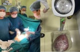 Người phụ nữ ai gặp cũng bảo mang bầu nhưng khi biết sự thật mọi người đều ngã ngửa