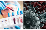 Tìm ra liệu pháp tiêu diệt 99,99% virus SARS-CoV-2