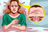 Thói quen xấu khiến sức khỏe 'tụt dốc', da nhăn nheo lão hoá từng ngày