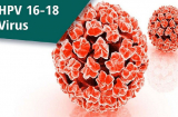 Tử cung tổn thương vì thói quen tệ hại, BS nói: Dùng đồ lót thế này bảo sao không nhiễm virus HPV?