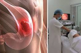 Người đoản thọ có 5 'điểm chung' vào ban đêm, thay đổi gấp nếu bạn mắc phải dù chỉ một