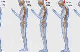 6 thói quen âm thầm phá hủy cột sống nhiều người vẫn làm mà không biết