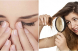 6 dấu hiệu cho thấy Sh88bet đăng ký miễn phí đang thiếu hụt collagen: Bổ sung ngay nếu không muốn già nua, ốm yếu