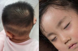 6 dấu hiệu cho thấy trẻ đang thiếu canxi, mẹ lưu ý để bổ sung cho con ngay