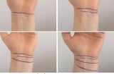 Nhìn xuống cổ tay, biết ngay vận mệnh giàu nghèo của bản thân