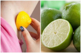 5 mẹo trị thâm nách đơn giản tại nhà cho vùng da dưới cánh tay luôn sáng mịn