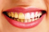 4 loại thực phẩm càng ăn càng khiến răng ố vàng, cố tẩy trắng cũng vô ích