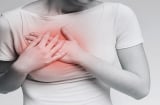 8 dấu hiệu sớm cảnh báo bệnh tim dễ bị nhầm là bệnh vặt, đặc biệt là dấu hiệu khi đánh răng