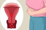 5 thứ khiến tử cung vô cùng 'khiếp sợ', điều thứ 2 nhiều chị em mắc phải nhất